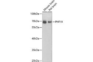 Western blot analysis of extracts of various cell lines, using PHF19 antibody (ABIN6128441, ABIN6145539, ABIN6145540 and ABIN6224090) at 1:1000 dilution. (PHF19 antibody  (AA 1-207))