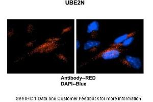 Immunohistochemistry (IHC) image for anti-Ubiquitin-Conjugating Enzyme E2N (UBE2N) (Middle Region) antibody (ABIN2777765)