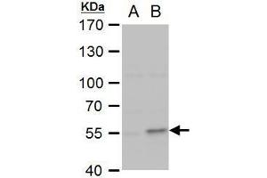 WB Image COL1A2 antibody [C2C3], C-term detects COL1A2 protein by western blot analysis. (COL1A2 antibody  (C-Term))