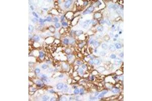 Image no. 2 for anti-Mitogen-Activated Protein Kinase Kinase Kinase Kinase 1 (MAP4K1) (C-Term) antibody (ABIN360390) (MAP4K1 antibody  (C-Term))