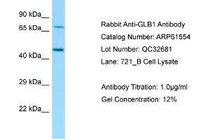 Western Blotting (WB) image for anti-Galactosidase, beta 1 (GLB1) (N-Term) antibody (ABIN2788837)