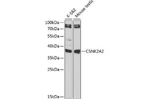 Western blot analysis of extracts of various cell lines, using CSNK2 antibody (ABIN6127663, ABIN6139128, ABIN6139129 and ABIN6217497) at 1:1000 dilution. (CSNK2A2 antibody  (AA 1-350))