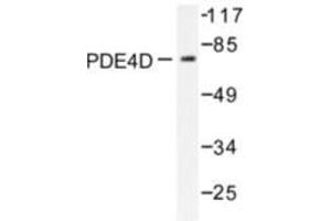 Image no. 1 for anti-phosphodiesterase 4D, cAMP-Specific (PDE4D) antibody (ABIN272057)