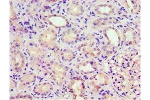 Immunohistochemistry of paraffin-embedded human kidney tissue using ABIN7153302 at dilution of 1:100 (GRK6 antibody  (AA 1-170))