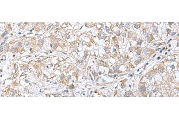 CGB5 antibody