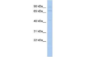 WB Suggested Anti-KLHL3 Antibody Titration: 0. (KLHL3 antibody  (N-Term))