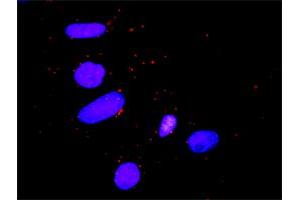 Proximity Ligation Analysis of protein-protein interactions between STAT5B and CTLA4. (STAT5B antibody  (AA 1-390))
