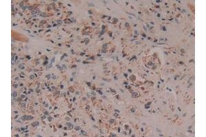 Immunohistochemistry (IHC) image for anti-Cytochrome C, Somatic (CYCS) (AA 5-100) antibody (ABIN7442270)
