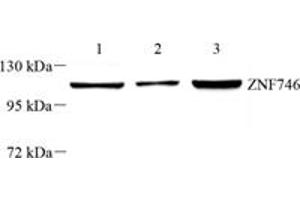 Western blot analysis of PARIS (ABIN7076272) at dilution of 1: 1000,Lane 1: THP-1 cell lysate,Lane 2: SH-SY5Y cell lysate,Lane 3: U251 cell lysate (ZNF746 antibody)