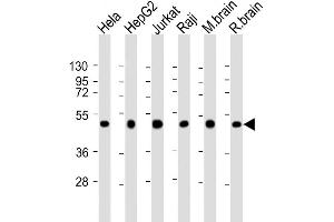 Western Blot at 1:2000 dilution Lane 1: Hela whole cell lysate Lane 2: HepG2 whole cell lysate Lane 3: Jurkat whole cell lysate Lane 4: Raji whole cell lysate Lane 5: mouse brain lysate Lane 6: rat brain lysate Lysates/proteins at 20 ug per lane. (CTBP1 antibody  (C-Term))
