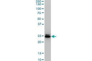HMGB2 monoclonal antibody (M02), clone 4G7. (HMGB2 antibody  (AA 1-195))