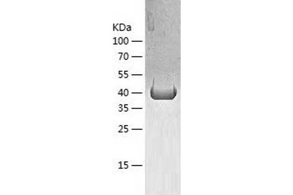 ATG4B Protein (AA 1-393) (His tag)