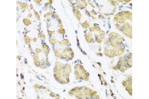 Immunohistochemistry of paraffin-embedded Human stomach using MLN Polyclonal Antibody at dilution of 1:100 (40x lens). (Motilin antibody)