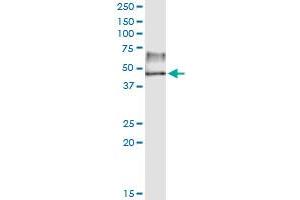 Immunoprecipitation of TBL2 transfected lysate using anti-TBL2 MaxPab rabbit polyclonal antibody and Protein A Magnetic Bead , and immunoblotted with TBL2 purified MaxPab mouse polyclonal antibody (B01P) . (TBL2 antibody  (AA 1-447))