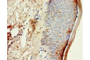 Immunohistochemistry of paraffin-embedded human skin tissue using ABIN7149004 at dilution of 1:100 (CST6 antibody  (AA 29-149))