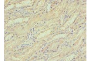 Immunohistochemistry of paraffin-embedded human kidney tissue using ABIN7148815 at dilution of 1:100 (CREB3 antibody  (AA 1-230))