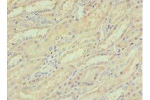 Immunohistochemistry of paraffin-embedded human kidney tissue using ABIN7148815 at dilution of 1:100 (CREB3 antibody  (AA 1-230))