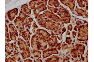 SIRPB1 antibody  (Isoform 3)