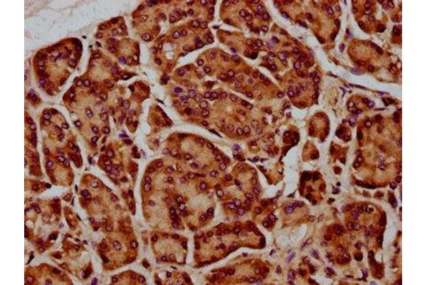 SIRPB1 antibody  (Isoform 3)