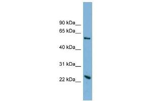 TMEM161A antibody used at 1 ug/ml to detect target protein. (TMEM161A antibody  (Middle Region))