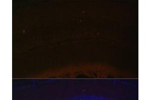 Immunofluorescence analysis of Mouse retina using RDH5 Polyclonal Antibody at dilution of 1:100 (40x lens). (RDH5 antibody)