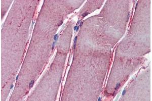 Human Skeletal Muscle: Formalin-Fixed, Paraffin-Embedded (FFPE) (GSTM2 antibody  (AA 90-190))