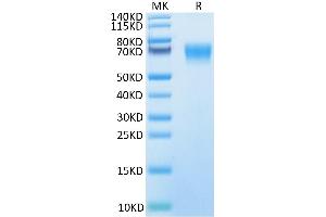 SDS-PAGE (SDS) image for Interleukin 18 Binding Protein (IL18BP) (AA 31-194) protein (Fc Tag) (ABIN7274976)