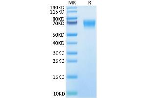Human IL-18BP on Tris-Bis PAGE under reduced condition. (IL18BP Protein (AA 31-194) (Fc Tag))