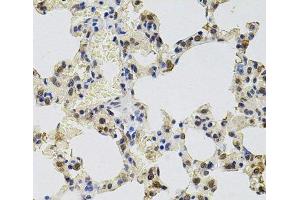 Immunohistochemistry of paraffin-embedded Rat lung using GTF2H2 Polyclonal Antibody at dilution of 1:100 (40x lens). (GTF2H2 antibody)