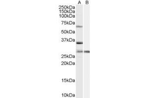 ABIN334465 (1µg/ml) staining of HeLa cell lysate (35µg protein in RIPA buffer) with (B) and without (A) blocking with the immunising peptide. (PRPF31 antibody  (Internal Region))