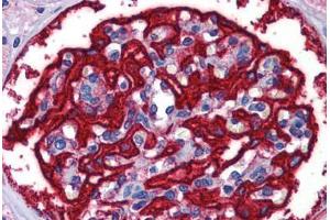 Human Kidney: Formalin-Fixed, Paraffin-Embedded (FFPE) (FTH1 antibody  (AA 110-159))