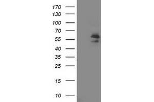 HEK293T cells were transfected with the pCMV6-ENTRY control (Left lane) or pCMV6-ENTRY ARFGAP1 (Right lane) cDNA for 48 hrs and lysed. (ARFGAP1 antibody)