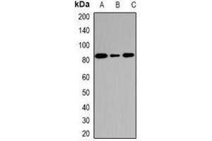Western blot analysis of DCTD expression in SW620 (A), mouse heart (B), rat heart (C) whole cell lysates.