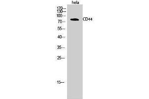 Western Blotting (WB) image for anti-CD44 (CD44) (Ser2152) antibody (ABIN3174267) (CD44 antibody  (Ser2152))