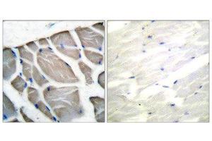 Immunohistochemistry (IHC) image for anti-Actin (pan) antibody (ABIN1848426) (Actin antibody  (pan))