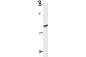 Gel: 10 % SDS-PAGE, Lysate: 40 μg, Lane: 231 cells, Primary antibody: ABIN7192403(SLC16A4 Antibody) at dilution 1/1200, Secondary antibody: Goat anti rabbit IgG at 1/8000 dilution, Exposure time: 10 seconds (SLC16A4 antibody)