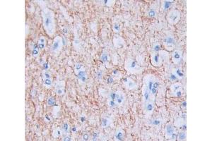 Used in DAB staining on fromalin fixed paraffin- embedded Kidney tissue (Calneuron 1 antibody  (AA 1-192))
