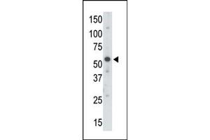Image no. 1 for anti-Ubiquitin-Like Modifier Activating Enzyme 3 (UBA3) (C-Term) antibody (ABIN356593) (UBA3 antibody  (C-Term))