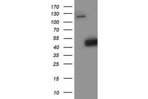 Western Blotting (WB) image for anti-Spermine Synthase, SMS (SMS) antibody (ABIN1501099) (SMS antibody)