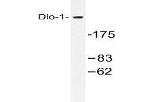 Western blot (WB) analysis with extracts from 293 cells using DIDO1 /  Dio-1 antibody .