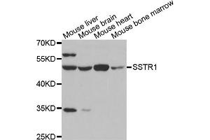 Western blot analysis of extracts of various cell lines, using SSTR1 antibody (ABIN5971605) at 1/500 dilution. (SSTR1 antibody)