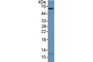 Western Blotting (WB) image for Keratin 9 (KRT9) ELISA Kit (ABIN6720501)