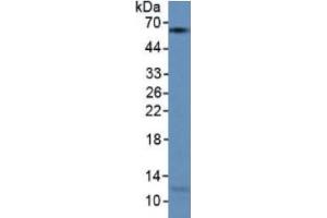 Rabbit Detection antibody from the kit in WB with Positive Control: Human lung lysate. (KRT9 ELISA Kit)