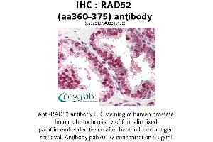 Image no. 1 for anti-RAD52 Homolog (S. Cerevisiae) (RAD52) (AA 360-375) antibody (ABIN1738702) (RAD52 antibody  (AA 360-375))