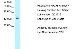 Western Blotting (WB) image for anti-Nuclear Receptor Subfamily 2, Group F, Member 6 (NR2F6) (N-Term) antibody (ABIN2779525) (NR2F6 antibody  (N-Term))
