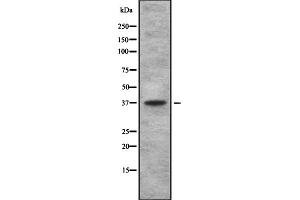 Western blot analysis of TAS2R using 293 whole cell lysates (TBXA2R antibody  (C-Term))