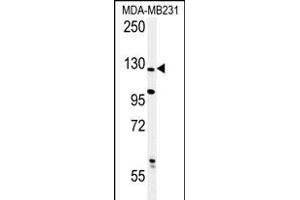 Western blot analysis of PHL Antibody (C-term) (ABIN652395 and ABIN2841923) in MDA-M cell line lysates (35 μg/lane). (PHLPP2 antibody  (C-Term))