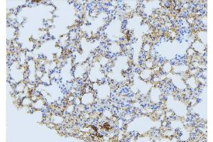 ABIN6275088 at 1/100 staining Mouse lung tissue by IHC-P. (MARCH3 antibody  (Internal Region))