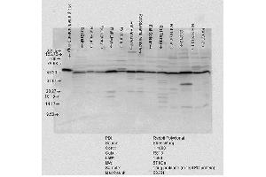 Western blot analysis of Rat tissue mix showing detection of PDI protein using Rabbit Anti-PDI Polyclonal Antibody . (P4HB antibody  (AA 409-509) (PerCP))