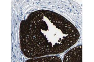 mTOR Antibody for IHC in human prostate tissue (MTOR antibody)